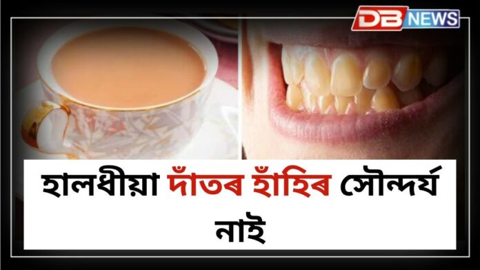 Teeth: দাঁত হালধীয়া হোৱাৰ কাৰণ জানেনে?